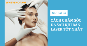 Góc bật mí: Cách chăm sóc da sau khi bắn laser tốt nhất