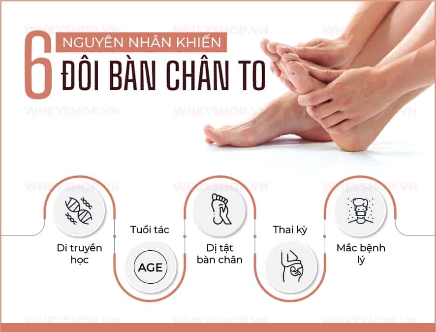 7 Cách làm bàn chân nhỏ lại hiệu quả không nên bỏ qua - WheyShop.vn