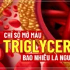 Nếu bạn đang băn khoăn về chỉ số mỡ máu Triglyceride bao nhiêu là nguy hiểm thì hãy cùng WheyShop điểm qua bài viết ngay sau đây...